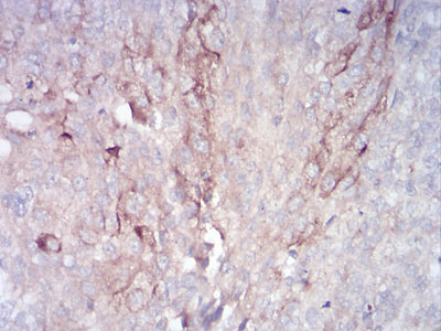 2 - RAB11FIP1 Antibody AO2084a