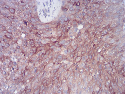 2 - RAB11FIP1 Antibody AO2085a