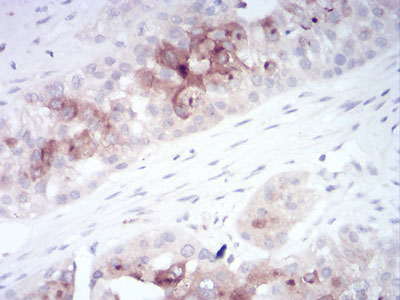 2 - RAB11FIP1 Antibody AO2085a