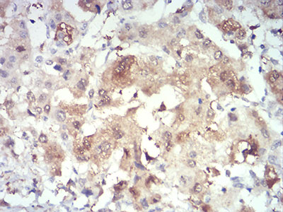 2 - PRDM4 Antibody AO2192a