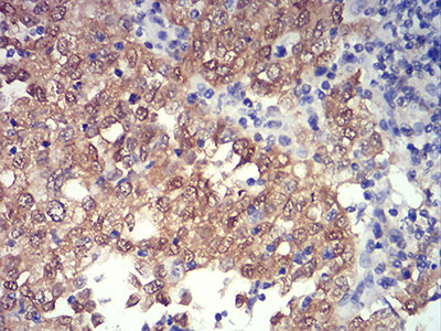 2 - PRDM4 Antibody AO2192a