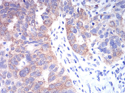 2 - TBCC Antibody AO2219a