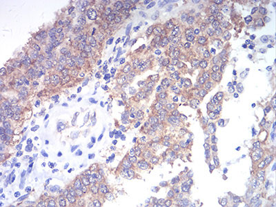 2 - TBCC Antibody AO2219a