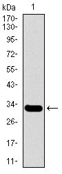 1 - SLC27A5 Antibody AO2262a