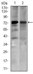 1 - SLC27A5 Antibody AO2262a