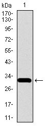 1 - SLC27A5 Antibody AO2263a