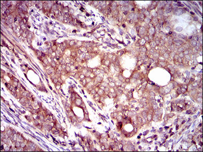 2 - DCTN4 Antibody AO2291a