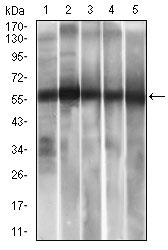 1 - ALDH2 Antibody AO2294a