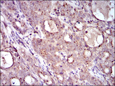 2 - MRPL42 Antibody AO2302a