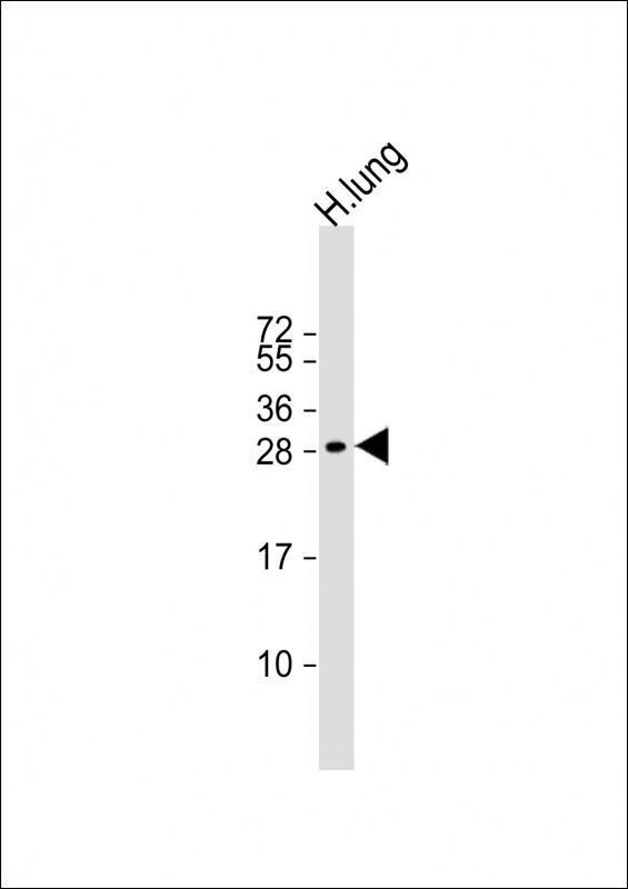 1 - MXI1 Antibody (Center) AP14974c