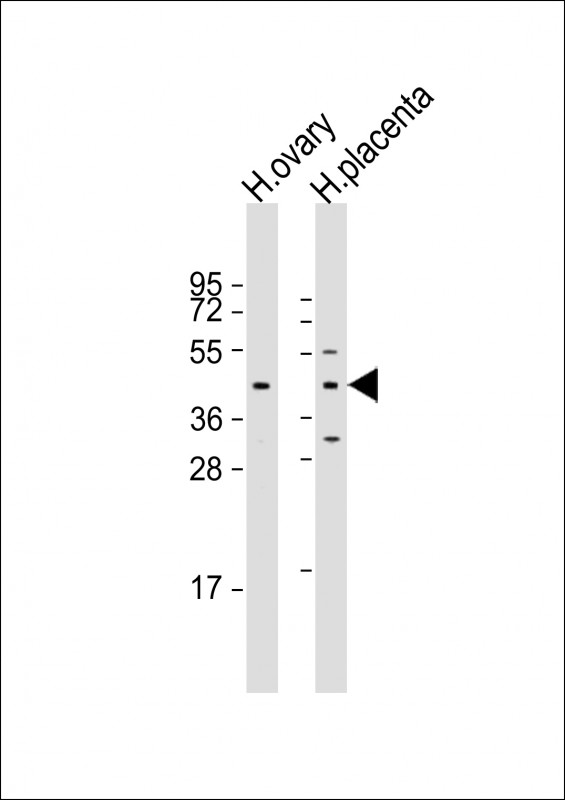 1 - ESX1 Antibody (N-term) AP17259a