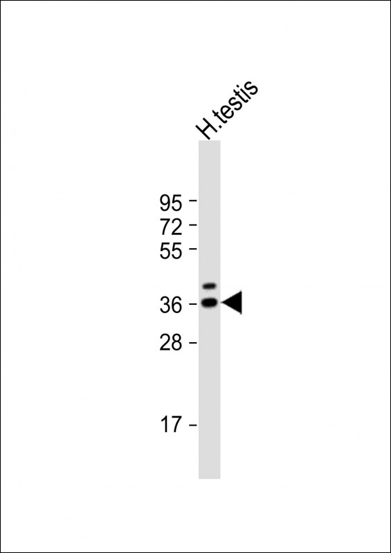 1 - TSPY3 Antibody (C-term) AP17280b