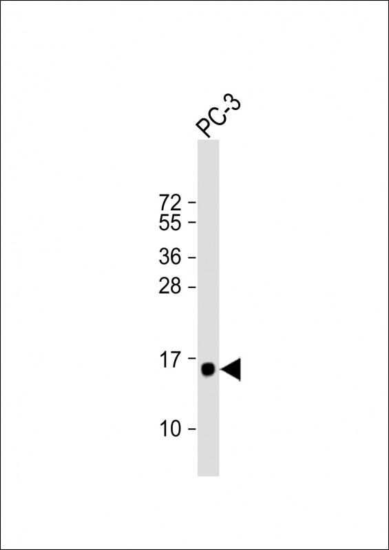 1 - DAP Antibody (N-term) AP20466a