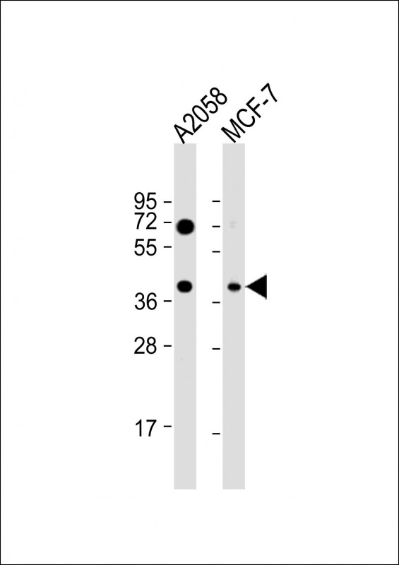 1 - GNA12 Antibody (S67) AP8035a