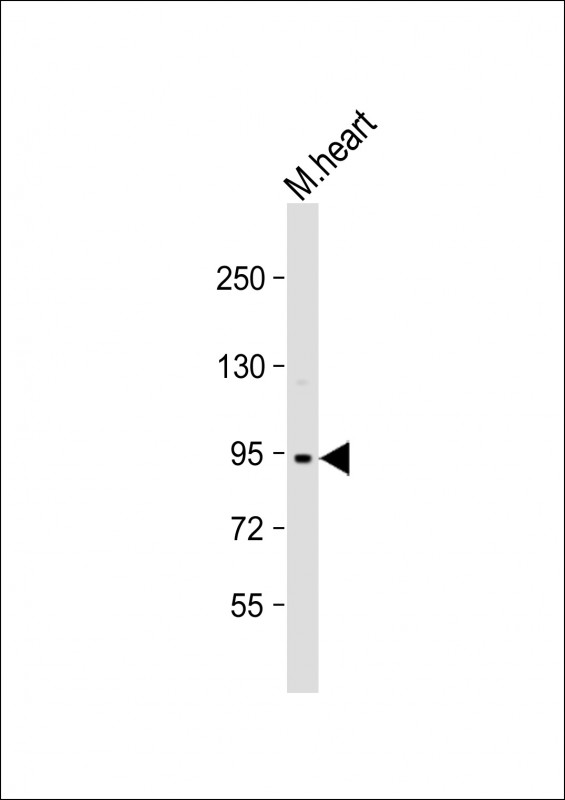 1 - Mouse TRPV3 Antibody (N-term) AP1425a