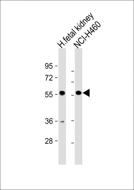 1 - XKRX Antibody (C-term) AP16779b