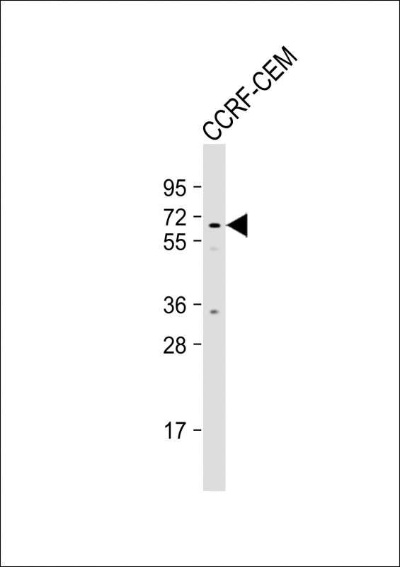 1 - MSL2 Antibody (N-term) AP17353a