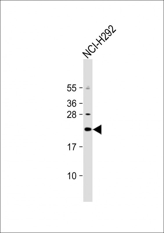 1 - DNAJC5G Antibody (Center) AP17525c