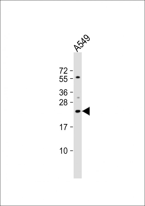 1 - ECSCR Antibody (C-term) AP18022b
