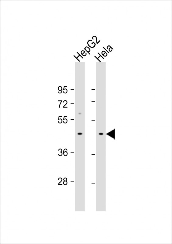 1 - GIPC3 Antibody (C-term) AP18407b