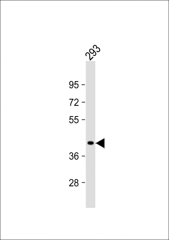 1 - GIPC2 Antibody (C-term) AP18639b