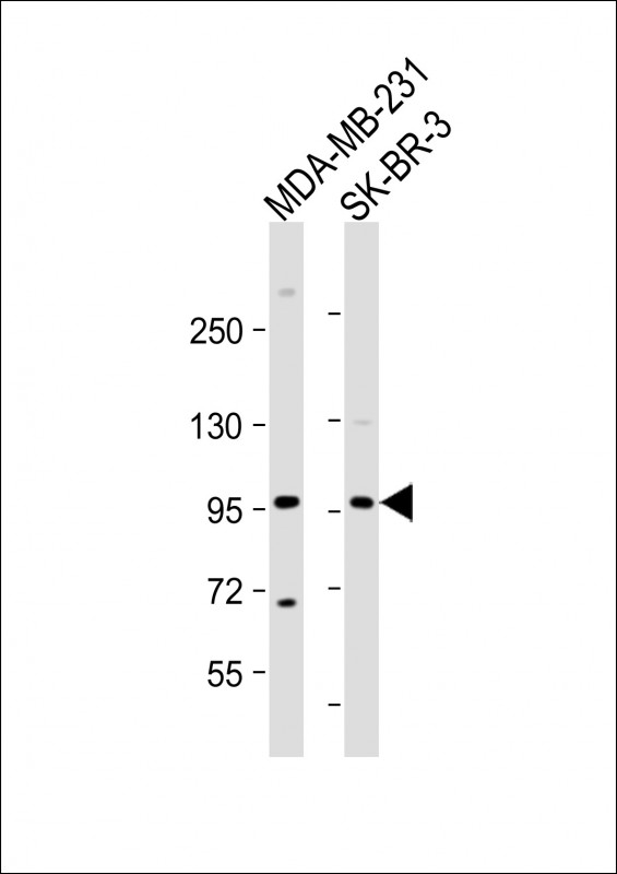 1 - TCHHL1 Antibody (N-term) AP18679a