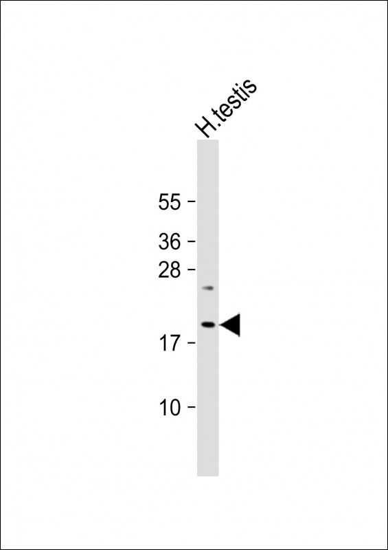 1 - VCX3A Antibody (N-term) AP18684a