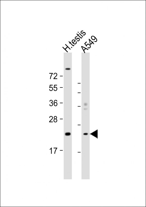 1 - HSPB9 Antibody (Center) AP19067c