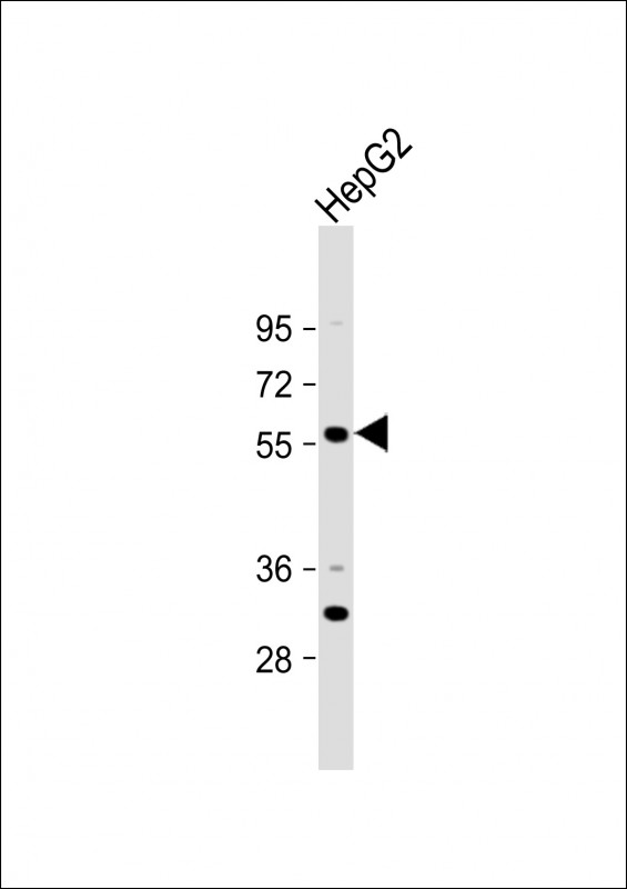 1 - ST6GAL2 Antibody(C-term) AP19472b