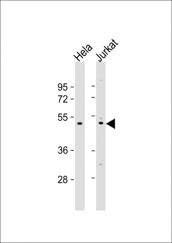 1 - ZNF577 Antibody (N-term) AP20394a