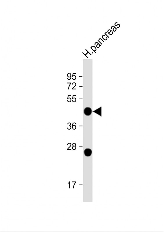 1 - NPTX2 Antibody (C-term) AP2718b