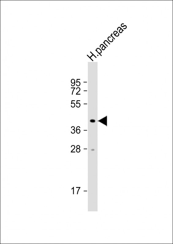 1 - NPTX2 Antibody (Center) AP2718c
