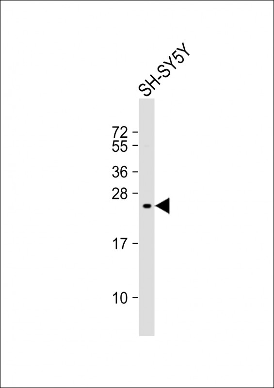 1 - KIP2 Antibody (N-term) AP8158a