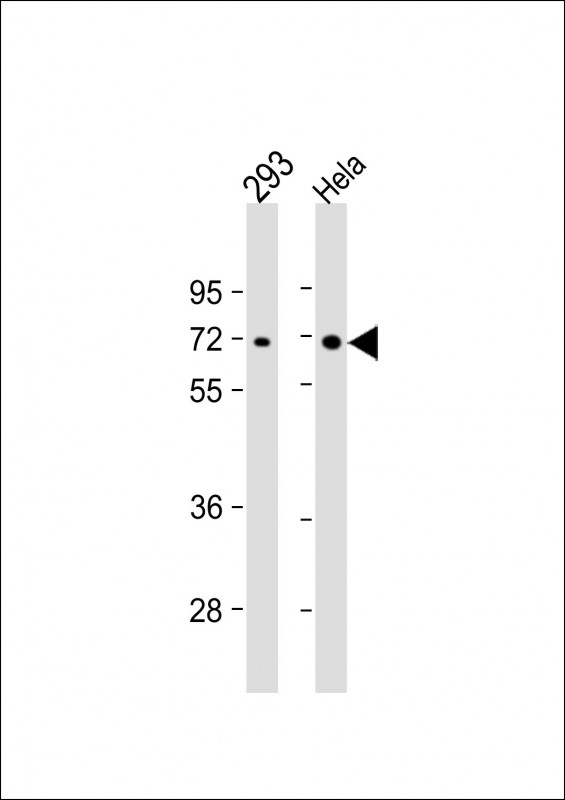 1 - PRKAA2 Antibody AM1887B