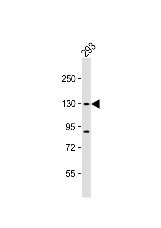 1 - DHX30 Antibody (N-term) AP17118a