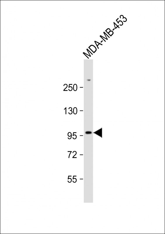 1 - ZBTB49 Antibody (N-term) AP17720a