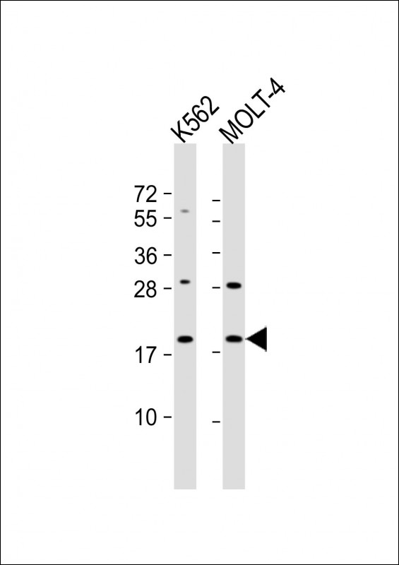1 - GKN1 Antibody (C-term) AP19065b