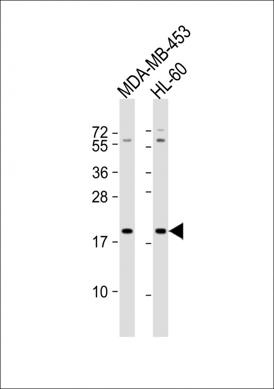1 - ZNF740 Antibody (N-term) AP20290a