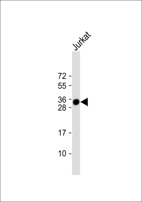 1 - TMX1 Antibody (C-term) AP20365b