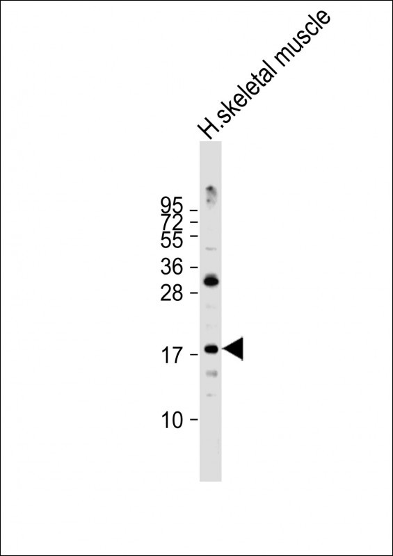1 - ND4L Antibody (C-term) AP17147b