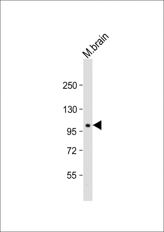 1 - PI4KA Antibody (Center) AP22156c