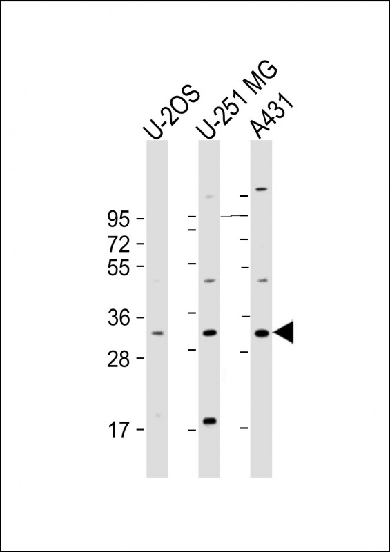 1 - FAM125A Antibody (Center) AP22166c