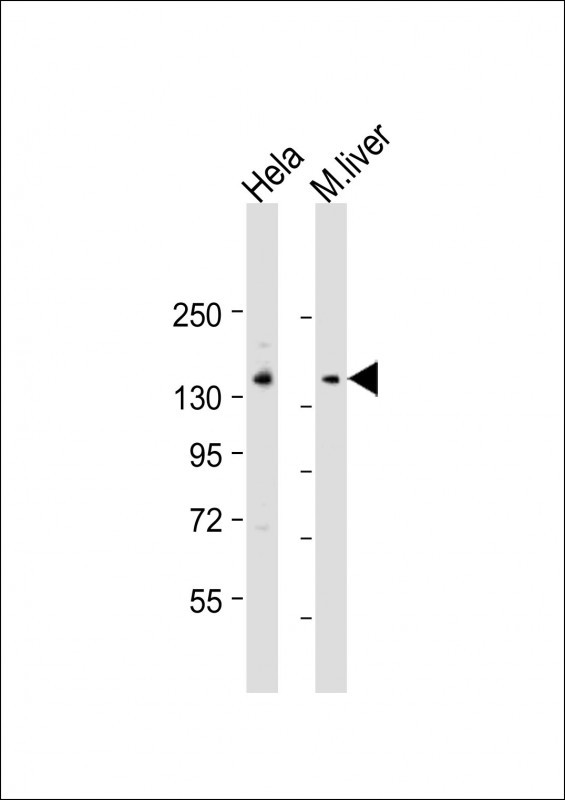 1 - LMTK3 Antibody (N-term) AP11540a