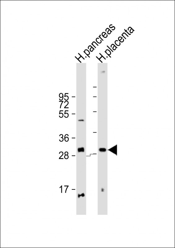 1 - PPP1R3E Antibody (Center) AP22188c
