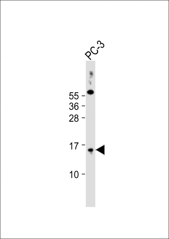 1 - SYNJ2BP Antibody (N-Term) AP22192a