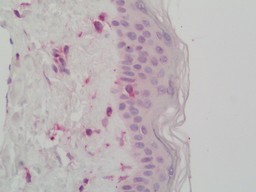 14 - Anti-RELN / Reelin Antibody  ALS17266