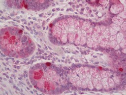14 - Anti-ROR1 Antibody  ALS17267