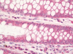 14 - Anti-RPL3 / Ribosomal Protein L3 Antibody  ALS17269