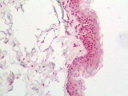 14 - Anti-XPC Antibody  ALS17270
