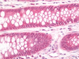 14 - Anti-TMED9 Antibody  ALS17271